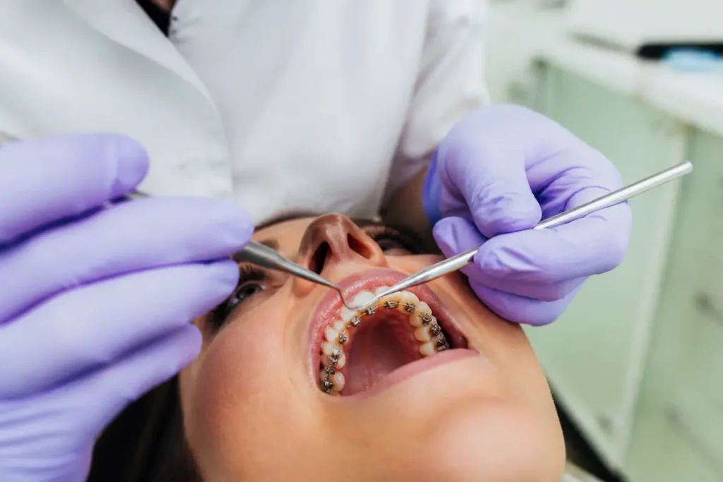 Orthodontiste ajustant appareil dentaire lingual, consultation concernant les prix et traitements esthétiques